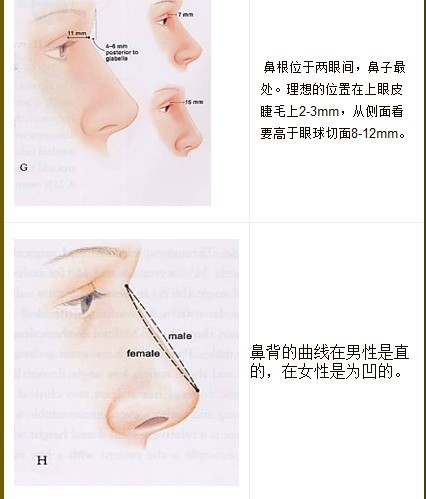 隆鼻手術介紹