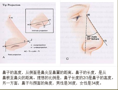 隆鼻手術介紹